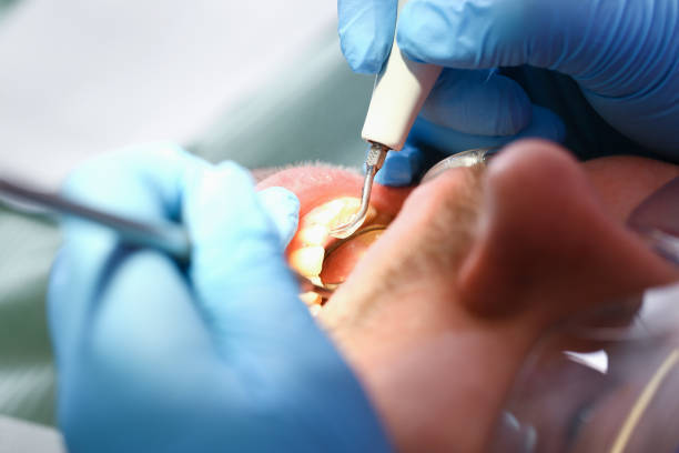 Best Emergency Cosmetic Dentistry in Port Neches, TX