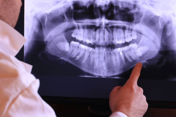 Best Emergency Dental Care for Abscessed Tooth in Port Neches, TX