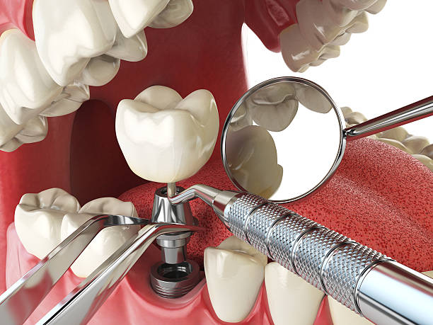 Best Emergency Dental Services for Seniors in Port Neches, TX