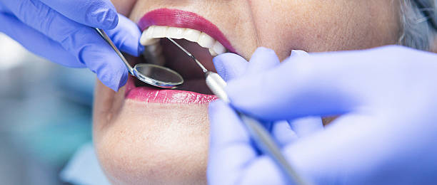 Best Emergency Root Canal Treatment in Port Neches, TX